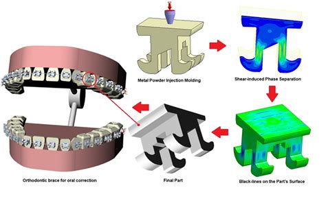 Metal Injection Molded Brackets: Revolutionizing Manufacturing 